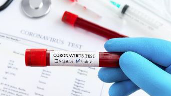Secretary of Health asks everyone to get tested