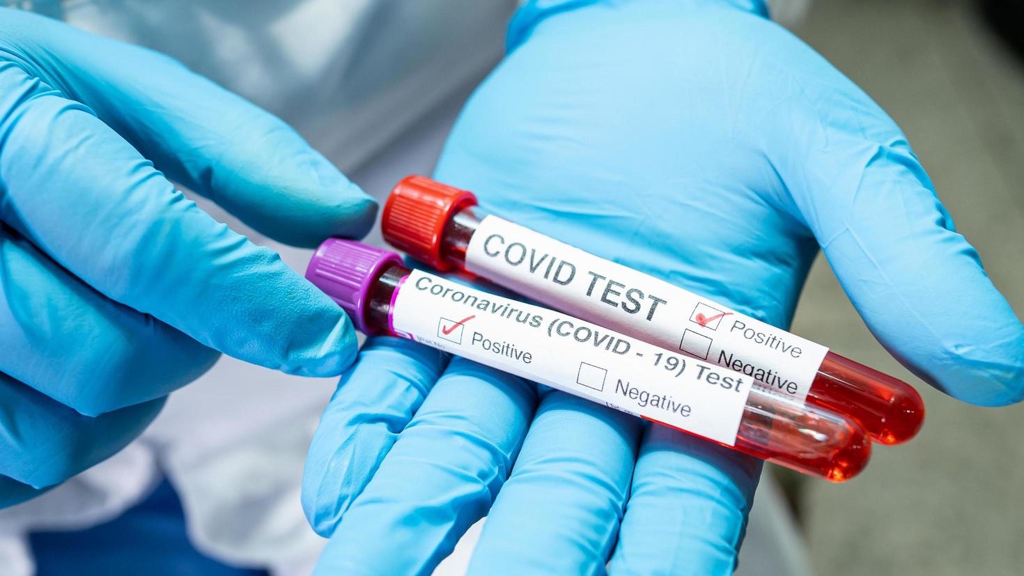 Cooks confirm first Covid-19 community case