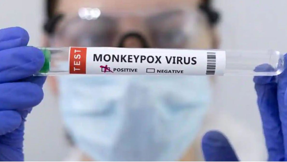 Te Marae Ora monitoring New Zealand’s monkeypox situation
